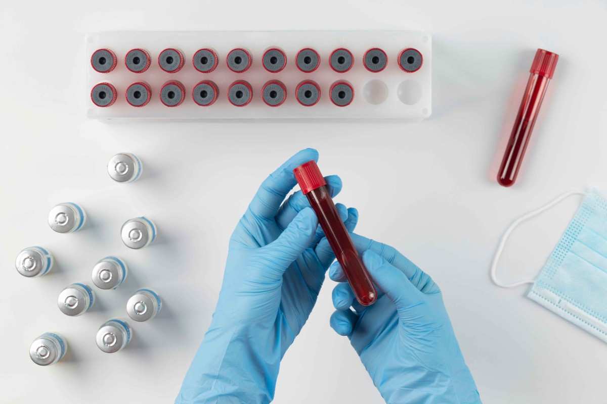 Blood culture test indication and interpretation in Madurai