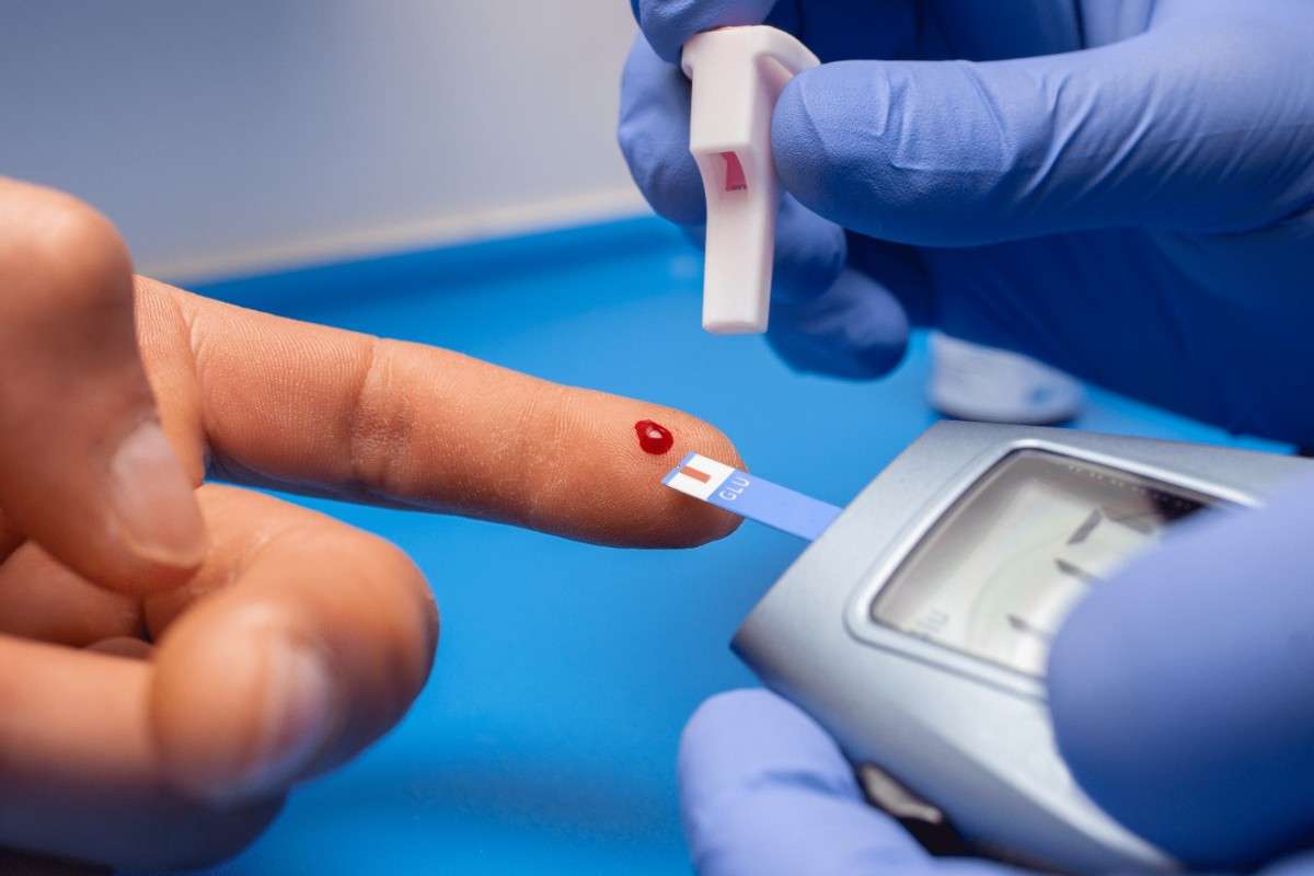 Diabetic follow up sugar level and HbA1c test in Madurai